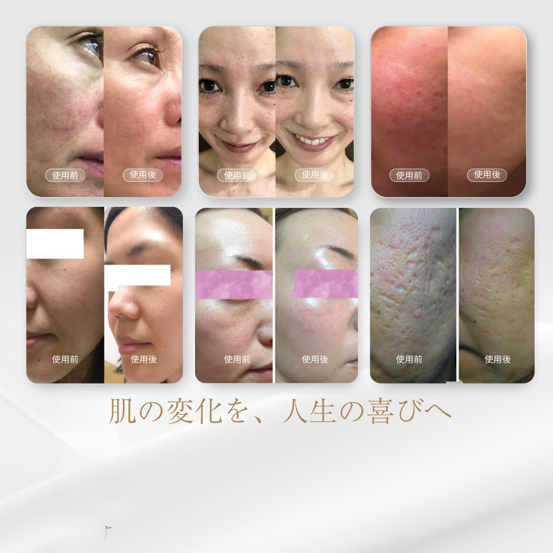マジェスティックスキン 5ml